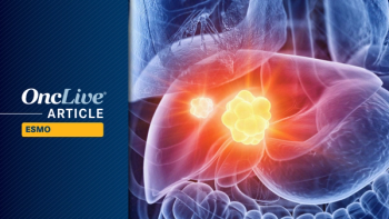 Tiragolumab/Atezolizumab/Bevacizumab in Advanced/Metastatic HCC | Image Credit: © Sebastian Kaulitzki - stock.adobe.com