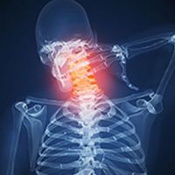 Durvalumab failed to improve overall survival over the EXTREME chemotherapy regimen in the frontline treatment of patients with recurrent or metastatic head and neck squamous cell carcinoma with tumors expressed high levels of PD-L1, missing a primary end point of the phase 3 KESTREL trial.