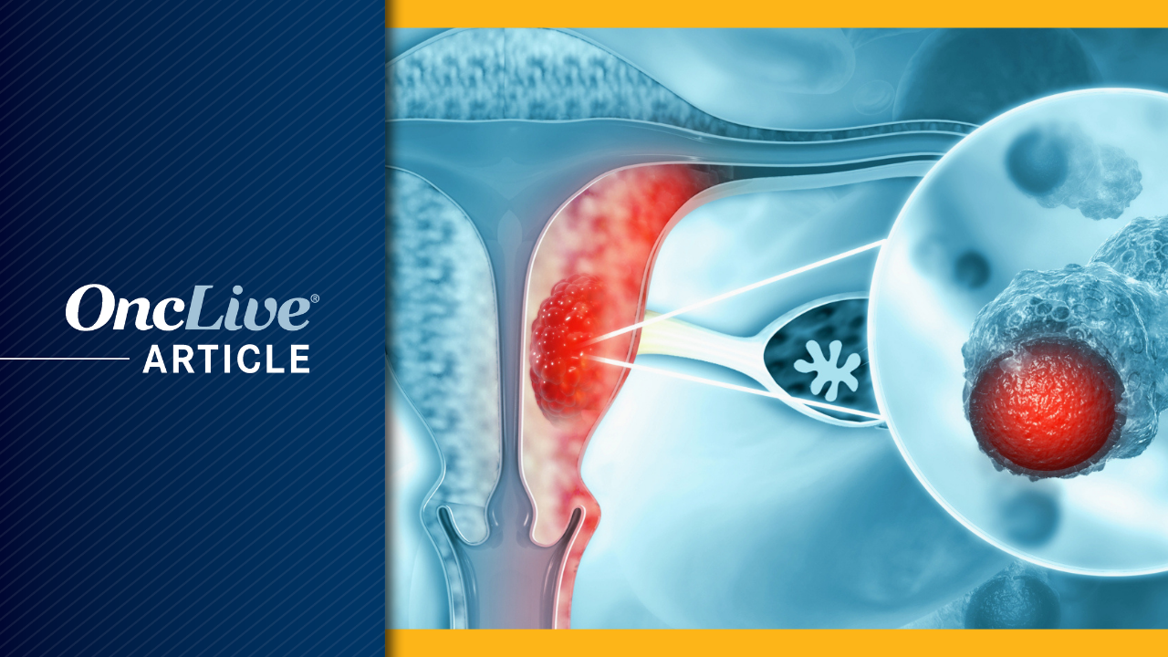 Selinexor in Endometrial Cancer | Image Credit: © Crystal light - stock.adobe.com