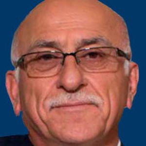 The OCM Is Both Good and Questionable