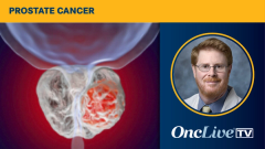 EMBARK Trial in Prostate Cancer | Image Credit: © Dr_Microbe - stock.adobe.com