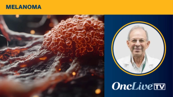 Mario Sznol, MD, Sylvester Comprehensive Cancer Center