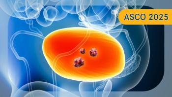 Urothelial Carcinoma |  Image Credit: © Matthieu  - stock.adobe.com