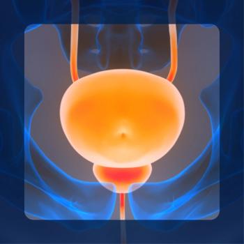 Upper Tract Urothelial Cancer | Image Credit: © magicmine – stock.adobe.com