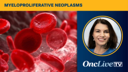 Dr George on the Data for Bezuclastinib in Non-Advanced Systemic Mastocytosis from the SUMMIT Trial