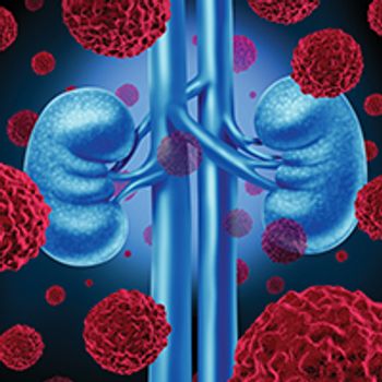Renal Cell Carcinoma