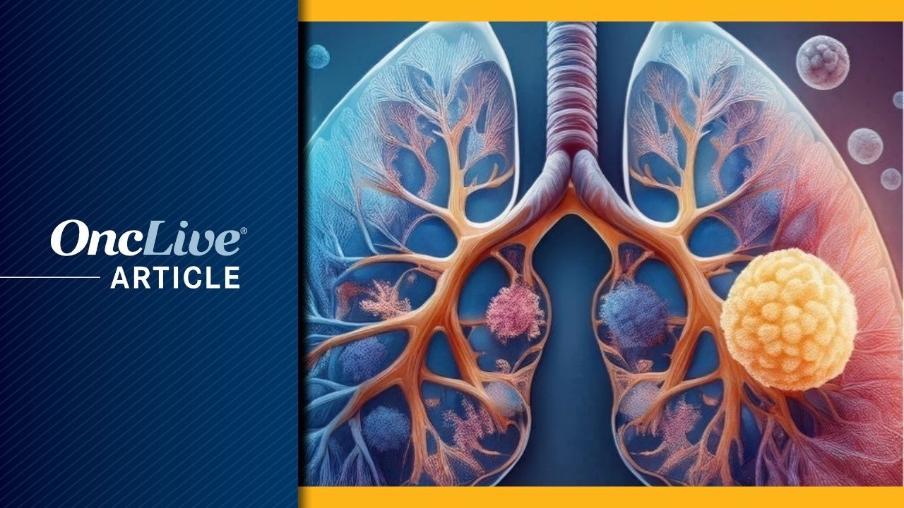 <![CDATA[New Study Shows Lung Cancer Surveillance in the United States Misses Most Patients; Northwestern Medicine Researchers Urge Universal Age-Based Screening]]>