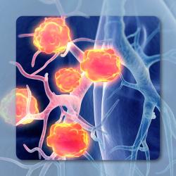 Preclinical Activity Support DLL3-TOPAbody in DLL3-Expressing SCLC and Other Tumors