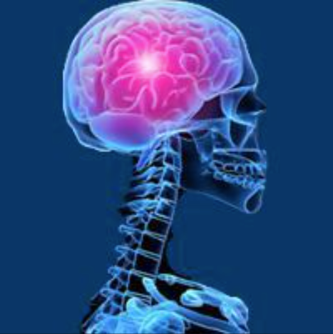 Low-Grade Glioma