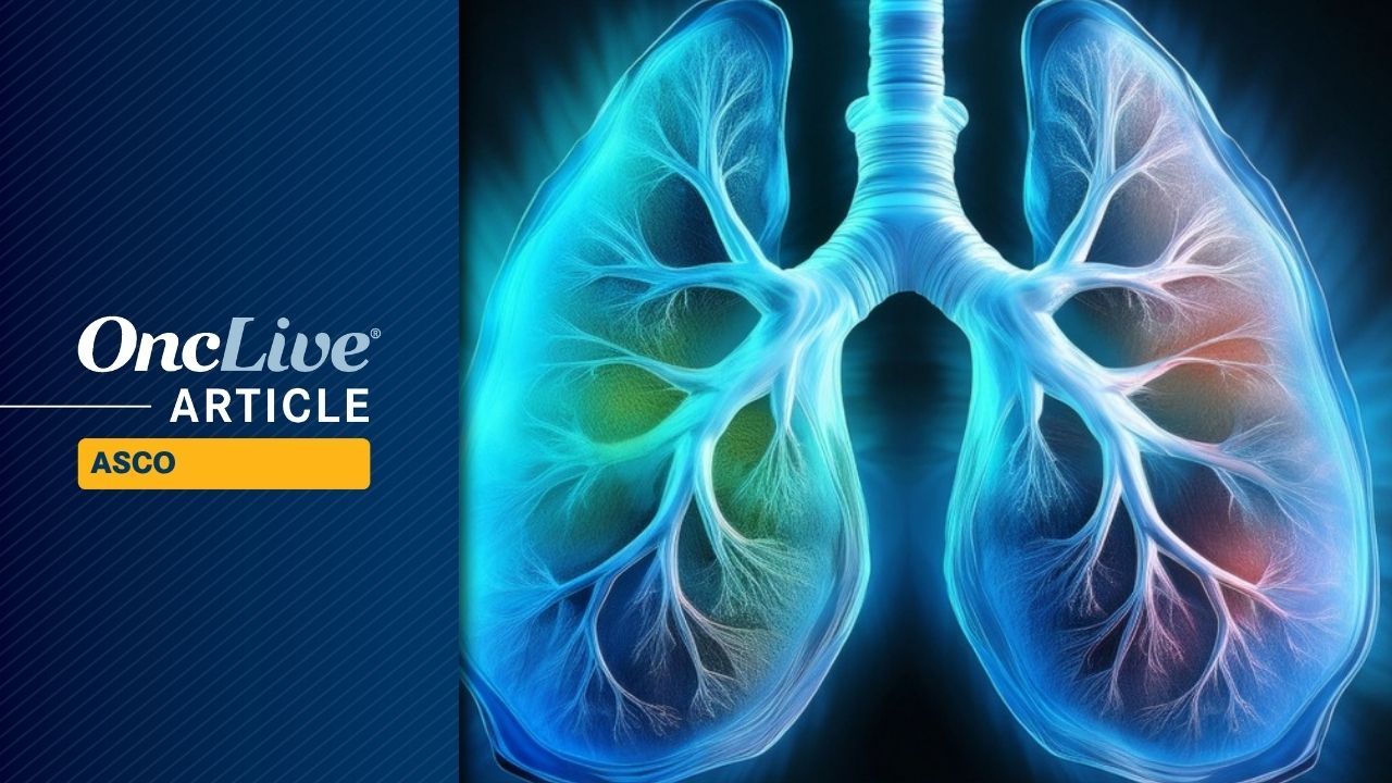 Ivonescimab Plus Chemo in Frontline Squamous NSCLC | Image Credit: © Ashling Wahner & MJH Life Sciences Using AI