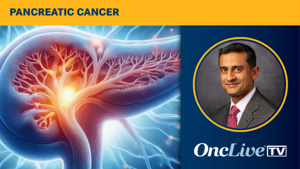 Shubham Pant, MD, MBBS, discusses data for daraxonrasib and its potential impact on pancreatic cancer management.