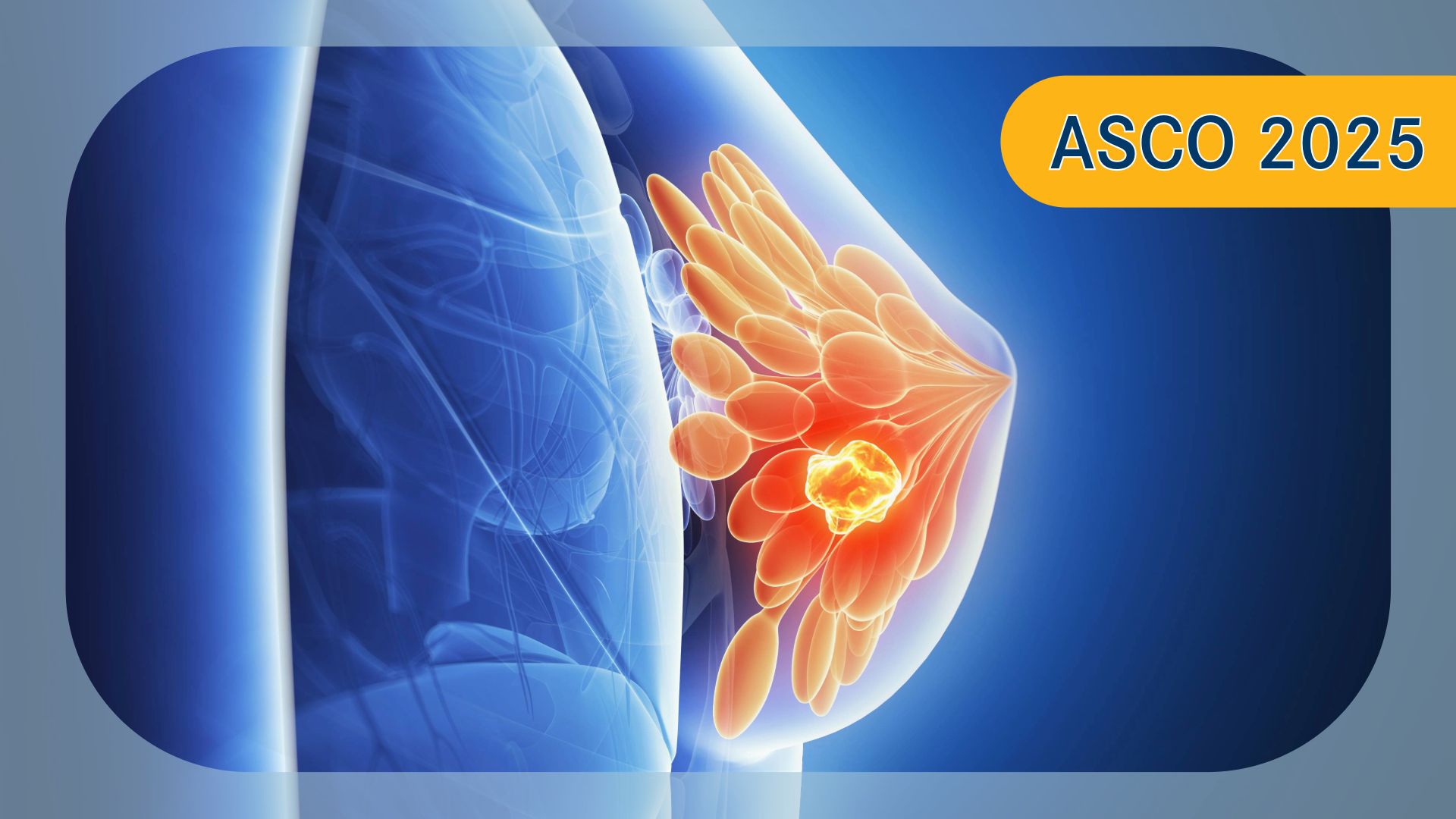 Sacituzumab Govitecan  Plus Pembrolizumab in TNBC | Image Credit: © Sebastian  Kaulitzki – stock.adobe.com