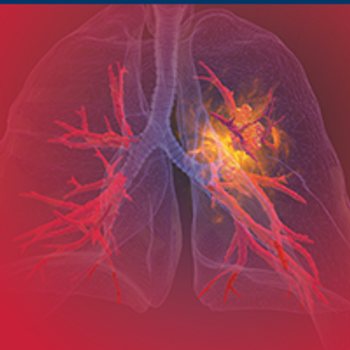 Live Broadcast to Explore a Treatment Option for EGFR Exon20 Insertion-Positive Metastatic Non-Small Cell Lung Cancer