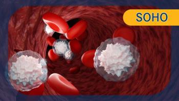 Loncastuximab Tesirine Plus Glofitamab in R/R DLBCL | Image Credit: © Om.Nom.Nom - stock.adobe.com