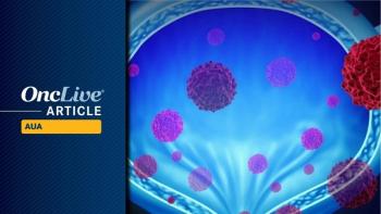 Non–muscle-invasive bladder cancer | Image Credit: © freshidea - stock.adobe.com