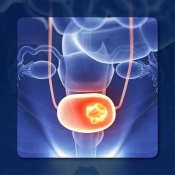 Bladder Transplant | Image Credit: © Katsyarina – stock.adobe.com