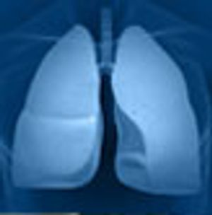 Leptomeningeal Metastases More Common in EGFR-Mutant NSCLC