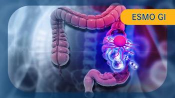  Metastatic colorectal cancer|   Image Credit: © Rasi - stock.adobe.com