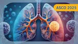 SCLC | Image by Ashling Wahner & MJH Life Sciences Using AI