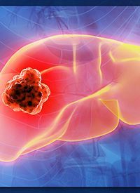 NMPA Approves sNDA for Toripalimab Plus Bevacizumab in Advanced