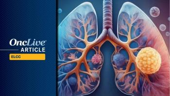 Setidegrasib in KRAS G12D NSCLC: ©Image by Ashling Wahner & MJH Life Sciences Using AI