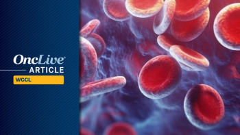 MAIC in Cutaneous T-cell Lymphoma Subtypes | Image Credit: © Oleksandr - stock.adobe.com