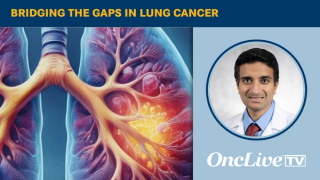 Sandip Patel, MD, professor of medicine and medical oncologist at the University of California San Diego