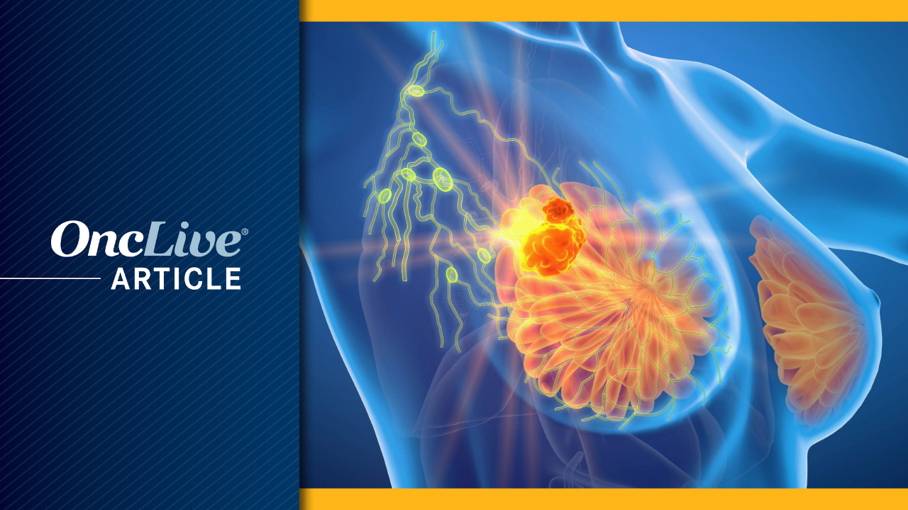 <![CDATA[International Breast Cancer Conference Features UCSF Experts]]>