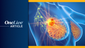 Metastatic Breast Cancer | Image Credit: © Axel Kock - stock.adobe.com