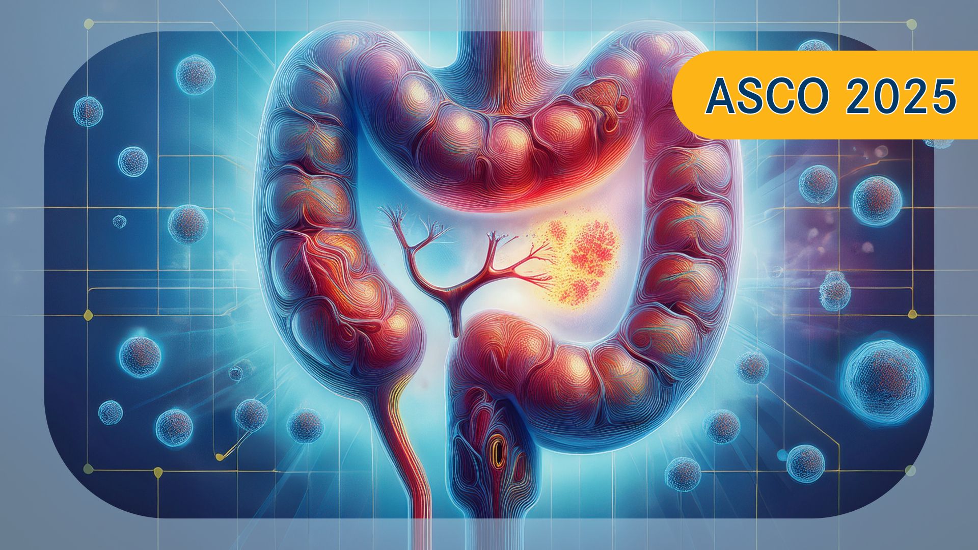 Stage III Colon Cancer  | Image Credit: Ashling Wahner  & MJH Life Sciences Using AI