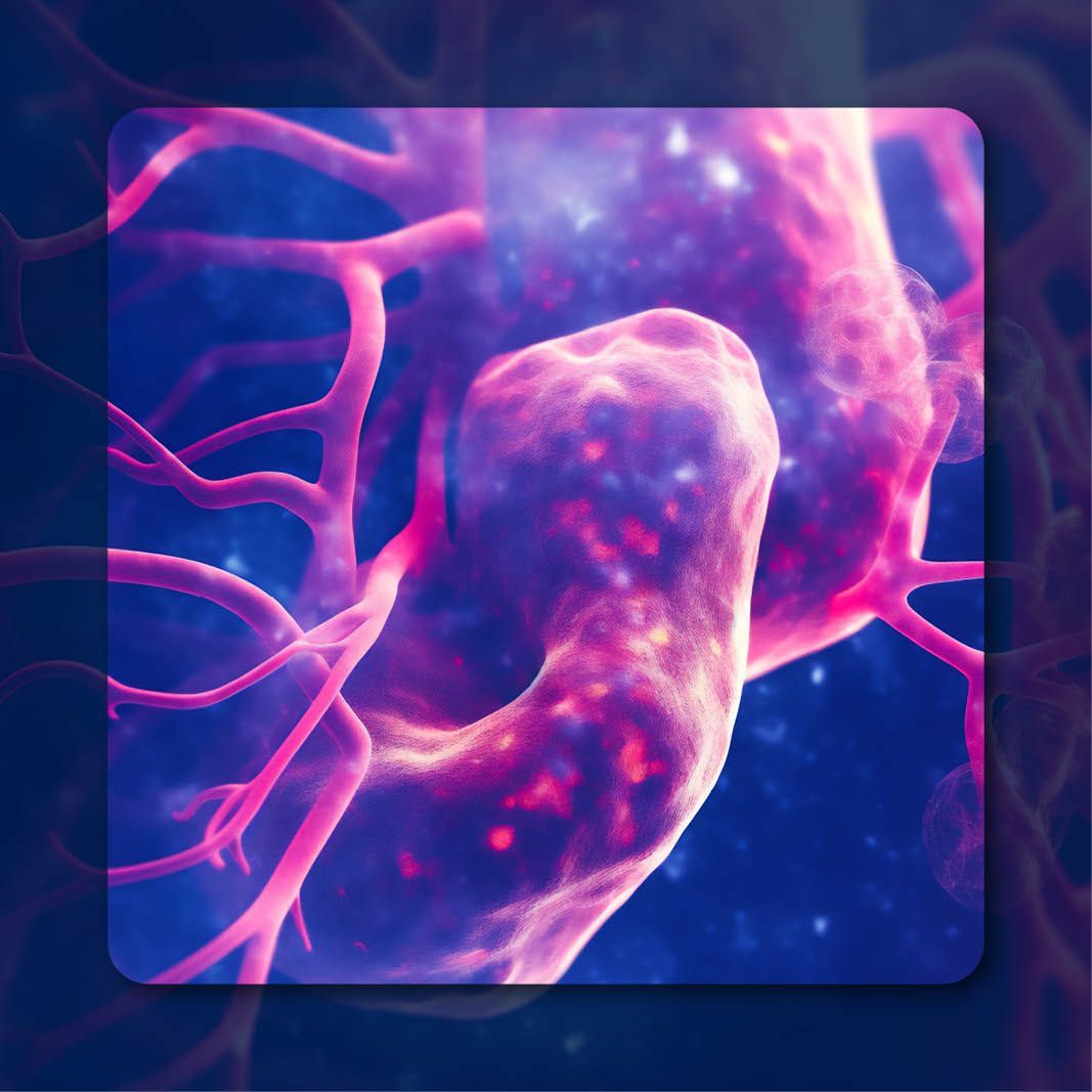 腎臓内科Controversy Sunvozertinib Under FDA Priority Review for NSCLC With EGFR