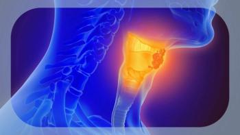 Oropharyngeal Cancer | Image credit:   © Lars Neumann - stock.adobe.com