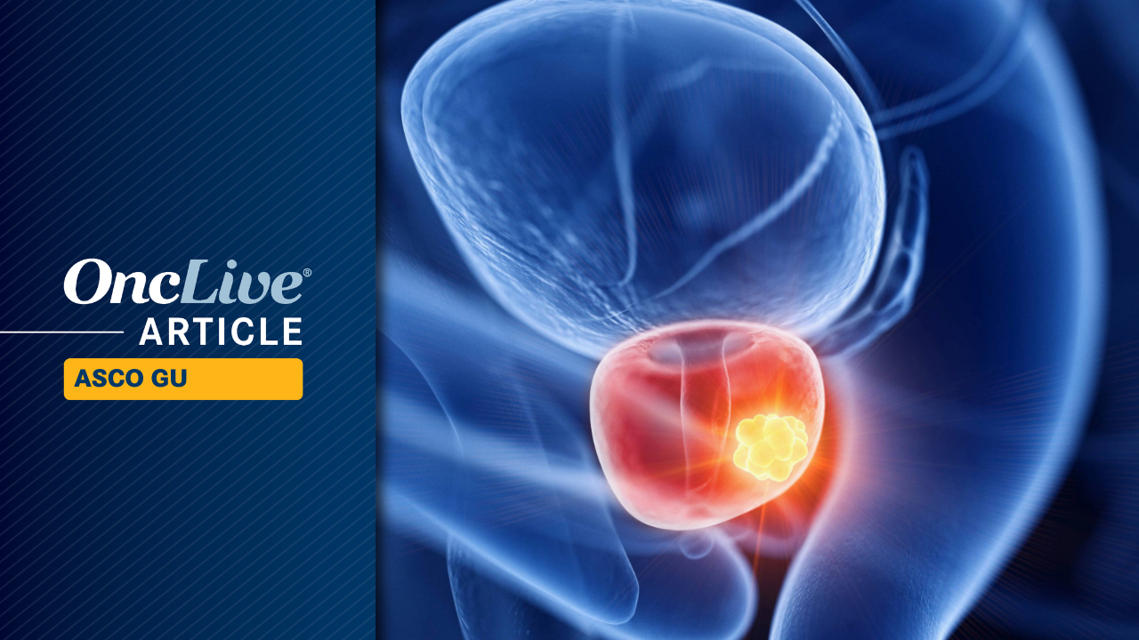 Localized Prostate Cancer | Im  © Dr_Microbe - stock.adobe.com