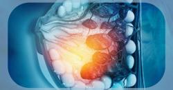 FDA Grants Fast Track Designation to GLSI-100 in HLA-A*02+, HER2+ Breast Cancer