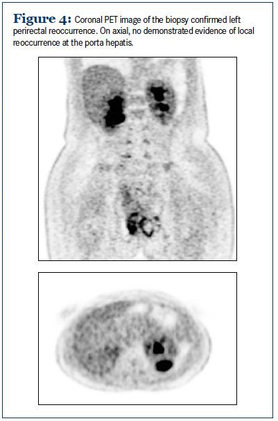 figure image