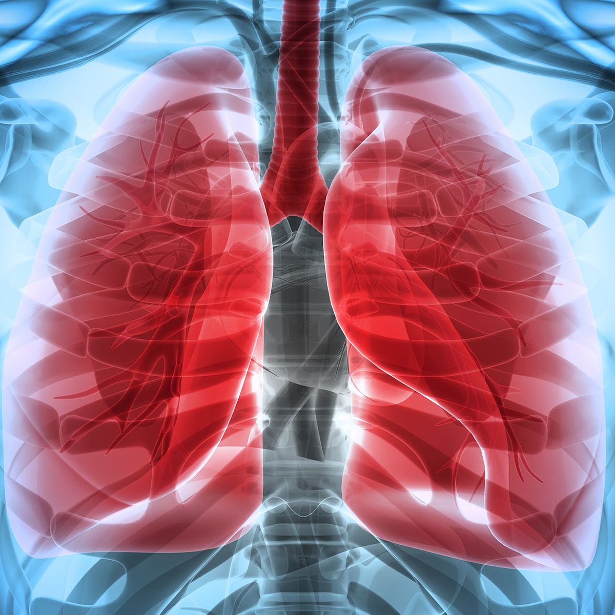lung cancer