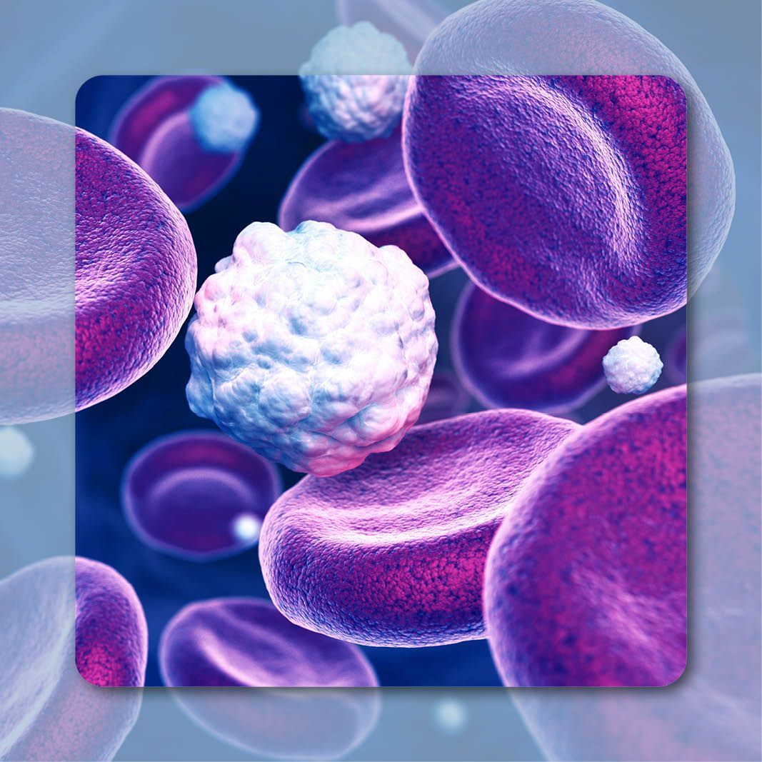 Myelofibrosis | Image Credit: © Tatiana Shepeleva – stock.adobe.com