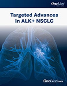 Targeted Advances in ALK+ NSCLC
