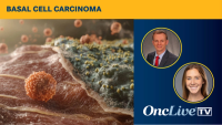 Neoadjuvant Cemiplimab in BCC of the Head and Neck | Image Credit: © Galina - stock.adobe.com