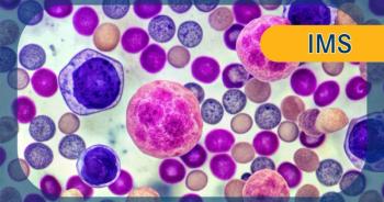 Multiple Myeloma | Image Credit: © Curie - stock.adobe.com