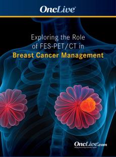 Exploring the Role of FES-PET/CT in Breast Cancer Management