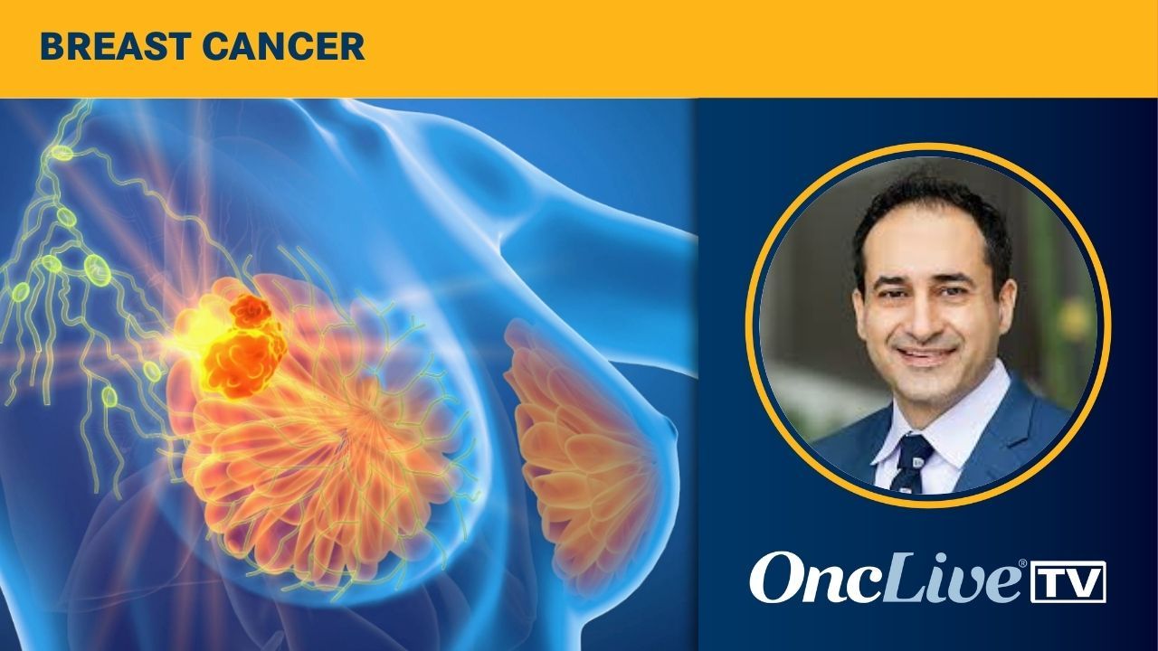 Cardio-Oncology in Breast Cancer Treatment Decision-Making | Image Credit: © Axel Kock - stock.adobe.com