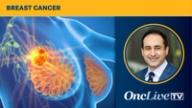 Cardio-Oncology in Breast Cancer Treatment Decision-Making | Image Credit: © Axel Kock - stock.adobe.com