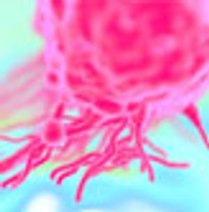 JAK Inhibitors Used as Anti-inflammatory Therapeutics for Pancreatic Cancer