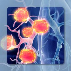 Taletrectinib Approved in China for Locally Advanced/Metastatic ROS1+ NSCLC