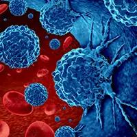 Mantle Cell Lymphoma | Image Credit: ©freshidea - stock.adobe.com