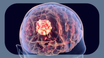 NF1-Associated PNs | Image Credit: © Dr_Microbe - stock.adobe.com