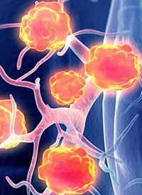 Lung Cancer - stock.adobe.com
