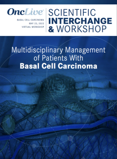 EP. 4 Multidisciplinary Management of Patients with Basal Cell Carcinoma