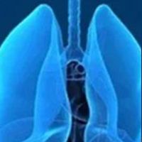 lung cancer